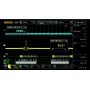 Oscilloscope 4 voies (100MHz - 500MHz) : DS/MSO7000